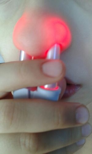 Customer photo review of Bionase Laser Allergy Treatment Kit