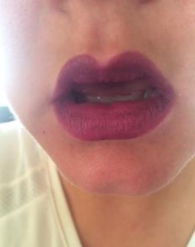Customer photo review of Professional Lip Enhancing Pump
