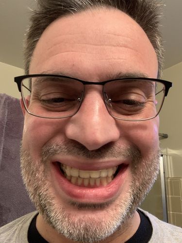 Customer photo review of Night Guard