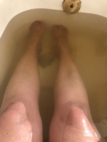 Customer photo review of Skin Repairing, Immune boosting, Detoxification Bath Pods (10 Pods)