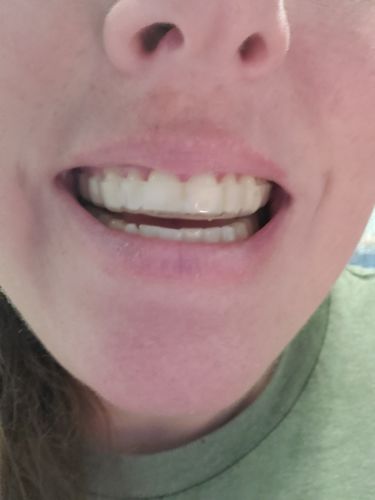 Customer photo review of Night Guard