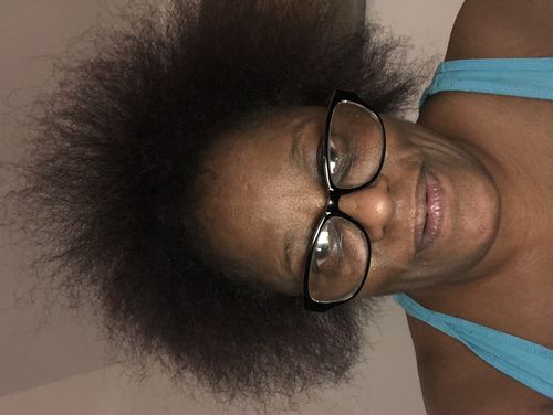 Customer photo review of PureFix Hair Elixir