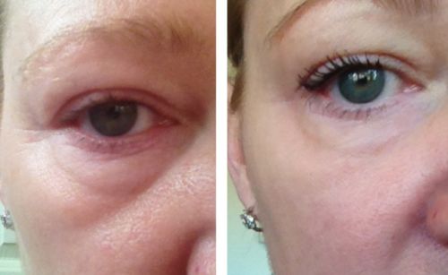 Customer photo review of Lumière Rouge ™