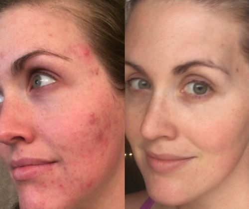 Customer photo review of Lumière Rouge ™