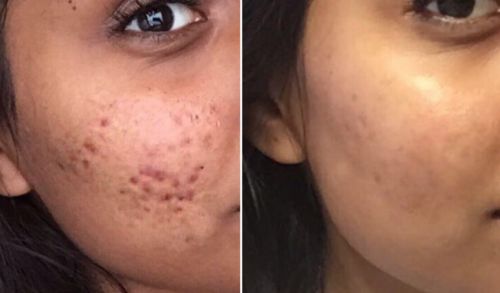 Customer photo review of Lumière Rouge ™