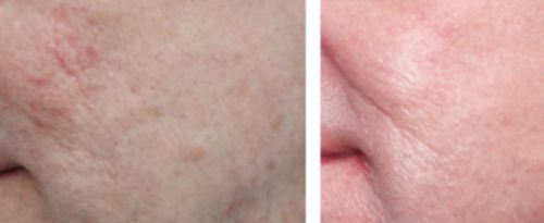 Customer photo review of Lumière Rouge ™