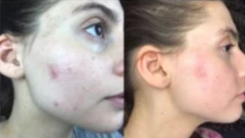 Customer photo review of Lumière Rouge ™