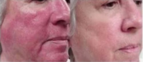 Customer photo review of Lumière Rouge ™