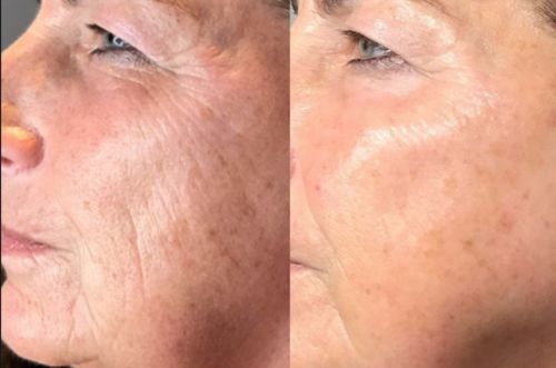 Customer photo review of Lumière Rouge ™