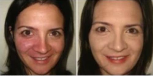 Customer photo review of Lumière Rouge ™