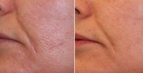 Customer photo review of Lumière Rouge ™