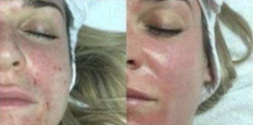 Customer photo review of Lumière Rouge ™