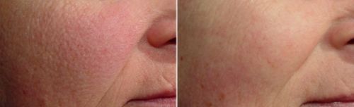 Customer photo review of Lumière Rouge ™