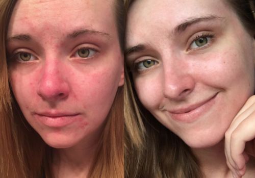 Customer photo review of Lumière Rouge ™