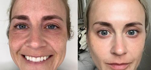 Customer photo review of Lumière Rouge ™