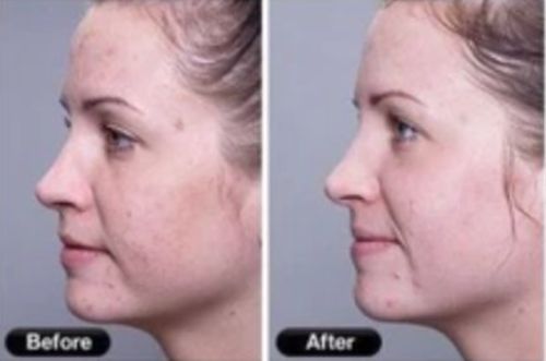 Customer photo review of Lumière Rouge ™