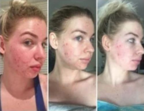 Customer photo review of Lumière Rouge ™