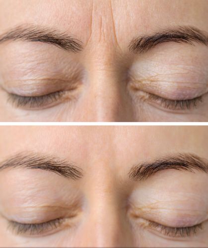 Customer photo review of Lumière Rouge ™