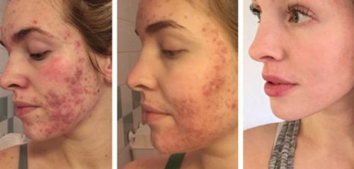 Customer photo review of Lumière Rouge ™