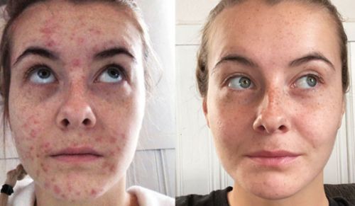 Customer photo review of Lumière Rouge ™