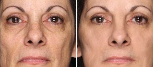 Customer photo review of Lumière Rouge ™