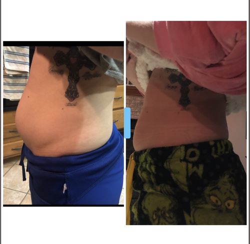 Customer photo review of Not live BOGO FREE 15 Uses Magnesium Therapy Wrap