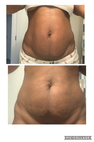 Customer photo review of Gift 15 Uses Magnesium Therapy Herbal Wrap
