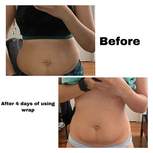 Customer photo review of 15 Uses Magnesium Therapy Herbal Wrap 20.00% Off Auto renew (Ships every 30 Days)