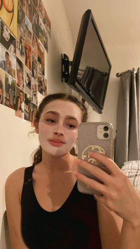 Customer photo review of Complete Skincare Bundle