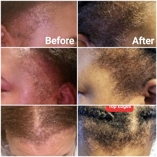 Customer photo review of Nae Nae's Hair Boost 9oz