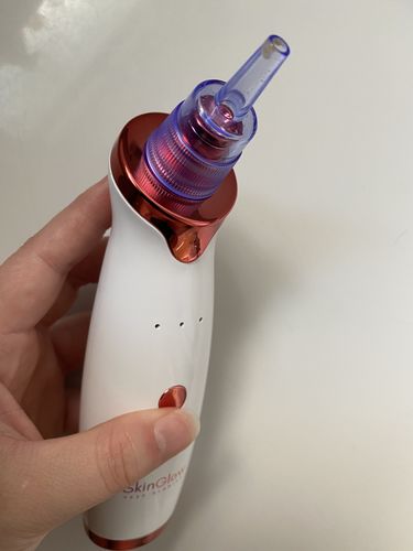 Customer photo review of SkinGlow Electric Cleanser - No More Blackheads