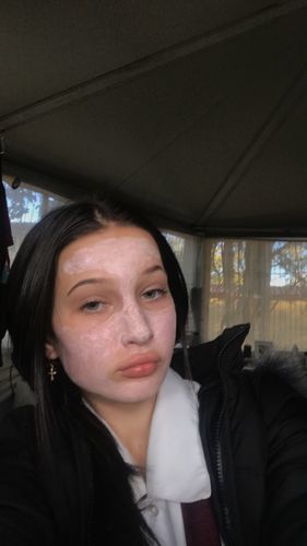 Customer photo review of Supercharged Skincare Bundle