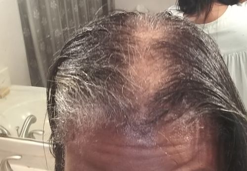 Customer photo review of PureFix Hair Elixir