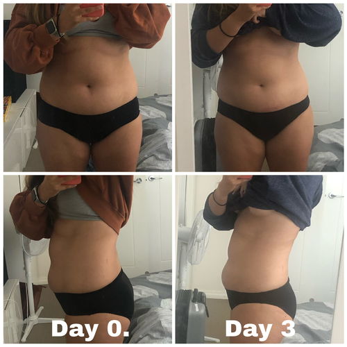 Customer photo review of 15 Uses Magnesium Therapy Herbal Wrap