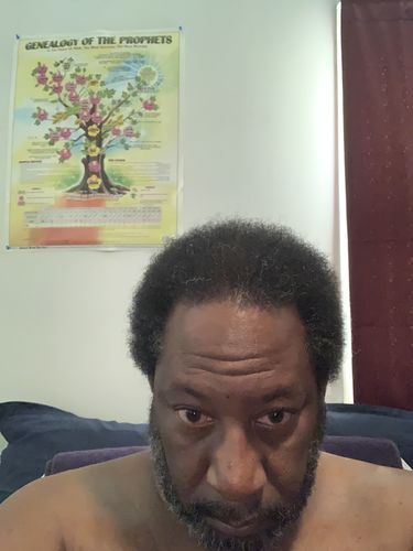 Customer photo review of PureFix Hair Elixir