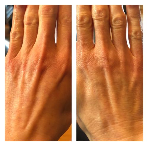 Customer photo review of Lumière Rouge ™