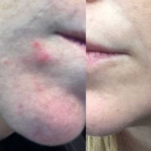 Customer photo review of Good Detox Essentiel - 1 mois