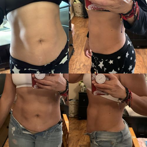 Customer photo review of Magnesium Therapy - Repair - Restore - Cellulite Reducing Bundle