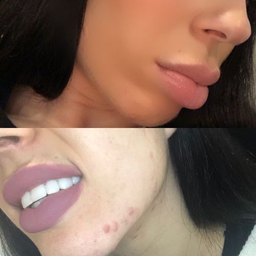 Customer photo review of AntiBacterial Cleansing Gel 200ml