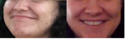 Customer photo review of Reforming Liquid