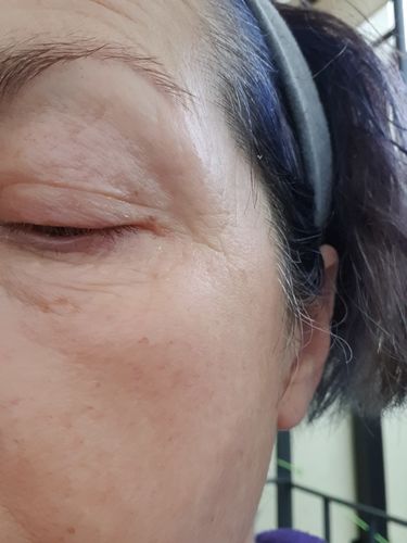 Customer photo review of Repair and Renew Cream