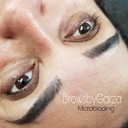 Customer photo review of Numb - Pre Procedure