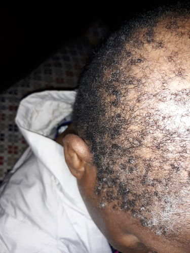 Customer photo review of PureFix Hair Elixir