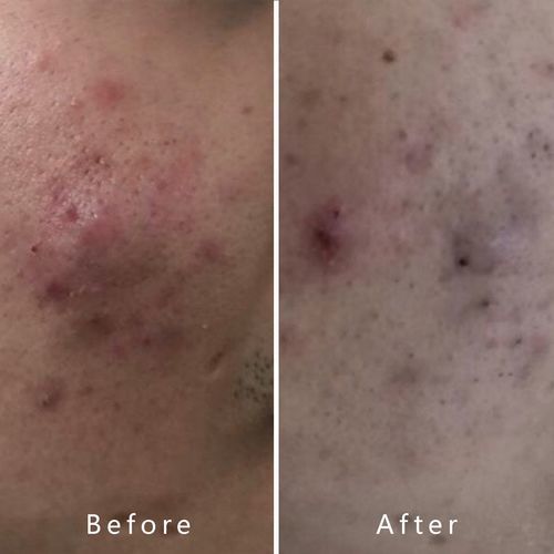 Customer photo review of Heal & Hydrate Limited Edition PR Gift Set