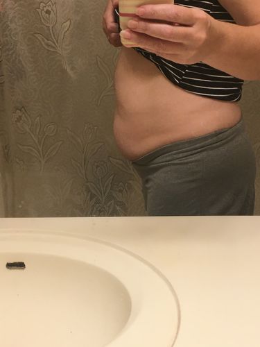Customer photo review of (BOGO) 45 Uses Herbal Magnesium Therapy Wrap: Legs/Core