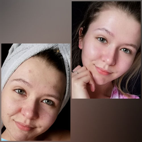 Customer photo review of Repair and Renew Cream