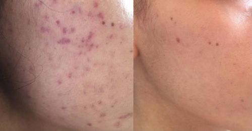 Customer photo review of Repair and Renew Cream