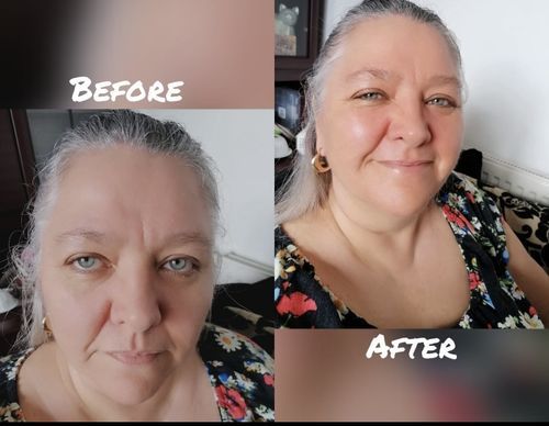 Customer photo review of Repair and Renew Cream