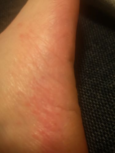 Customer photo review of Repair and Renew Cream