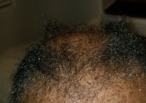 Customer photo review of PureFix Hair Elixir